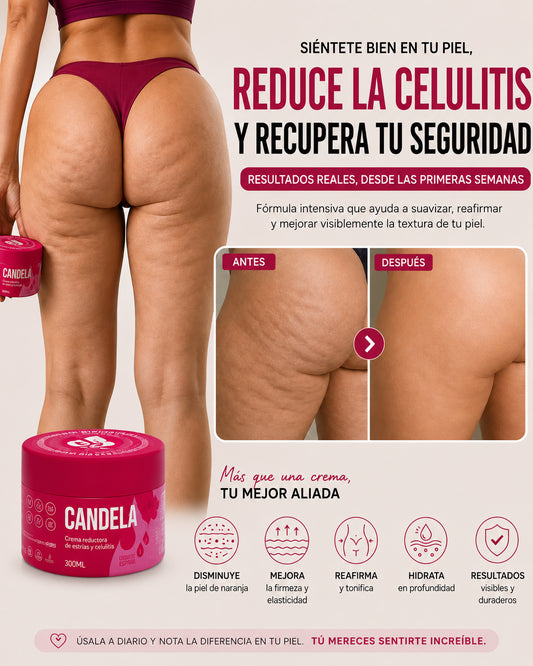 Crema Antiestrías y Anticelulítica Efecto Reafirmante Térmico – Candela® (300 ml)