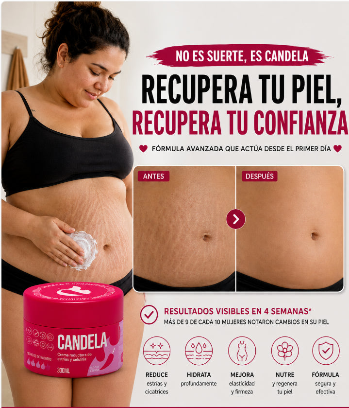 Crema Antiestrías y Anticelulítica Efecto Reafirmante Térmico – Candela® (300 ml)