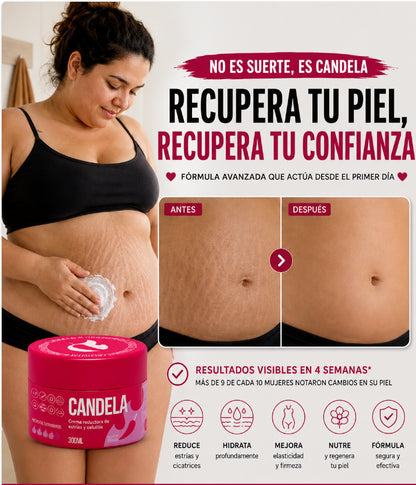Crema Antiestrías y Anticelulítica Efecto Reafirmante Térmico – Candela® (300 ml)