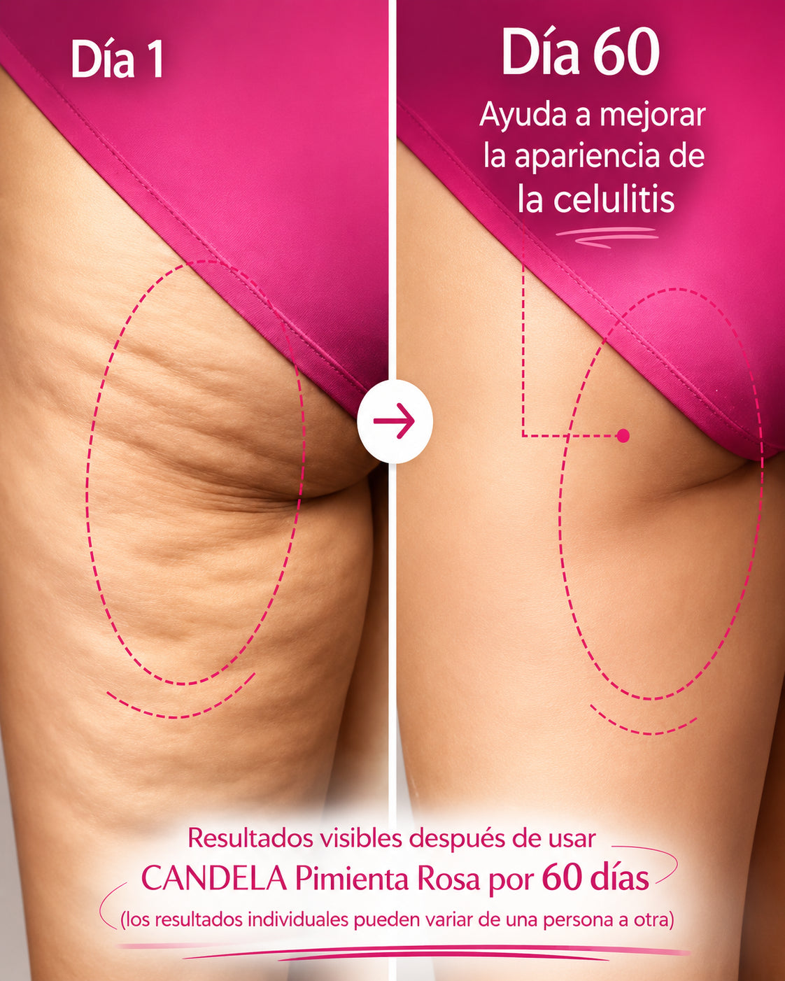 Crema Antiestrías y Anticelulítica Efecto Reafirmante Térmico – Candela® (300 ml)