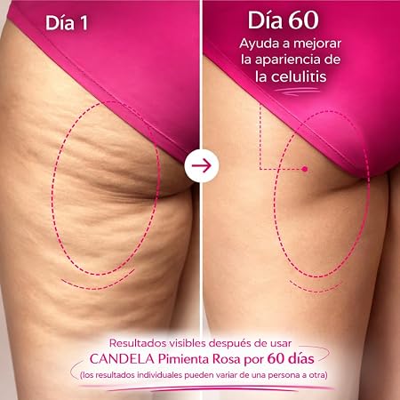🔥 Candela 🔥 Menos Estrías, Más Seguridad