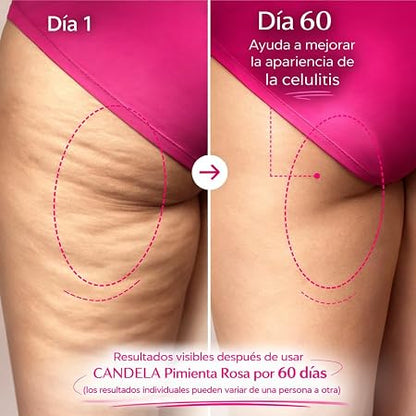 🔥 Candela 🔥 Menos Estrías, Más Seguridad