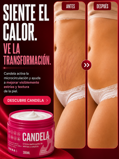 Crema Antiestrías y Anticelulítica Efecto Reafirmante Térmico – Candela® (300 ml)
