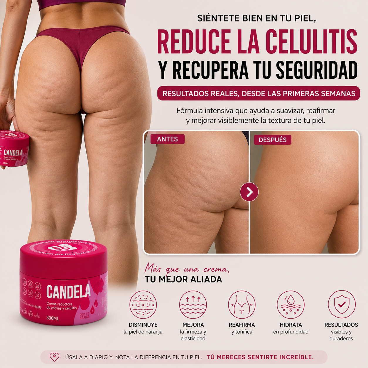 🔥 Candela 🔥 Menos Estrías, Más Seguridad