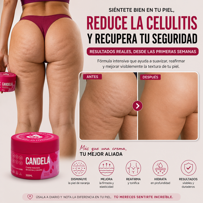 🔥 Candela 🔥 Menos Estrías, Más Seguridad